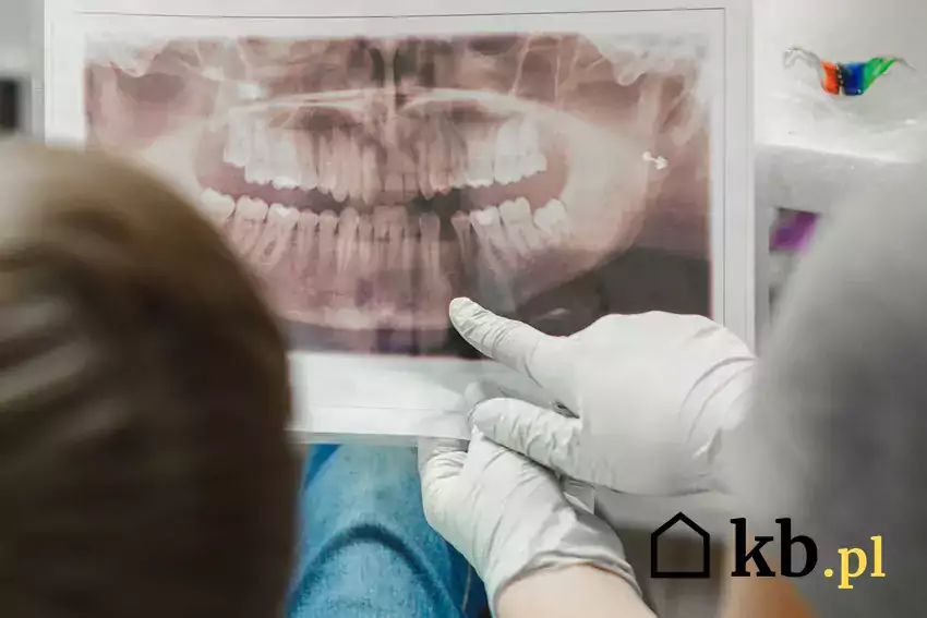 Koszt leczenia paradontozy u dentysty