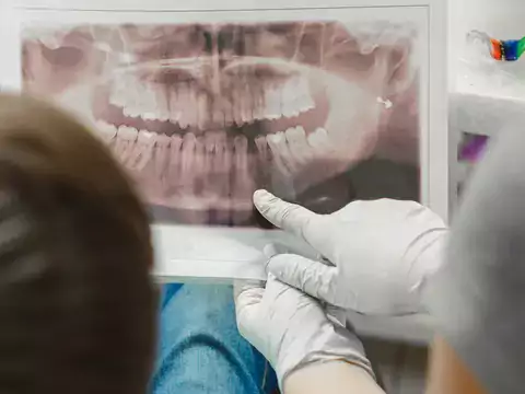 Ceny leczenia paradontozy u dentystów