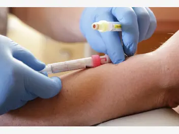 Ilustracja artykułu cennik badania nerek z krwi - sprawdź aktualne ceny usługi