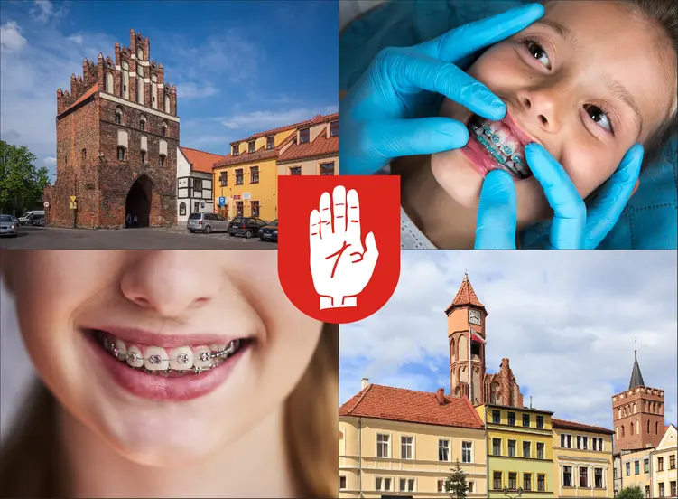 Brodnica - cennik ortodontów - sprawdź lokalne ceny aparatów na zęby