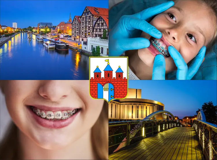 Bydgoszcz - cennik ortodontów - sprawdź lokalne ceny aparatów na zęby