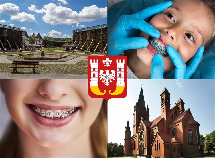 Inowrocław - cennik ortodontów - sprawdź lokalne ceny aparatów na zęby