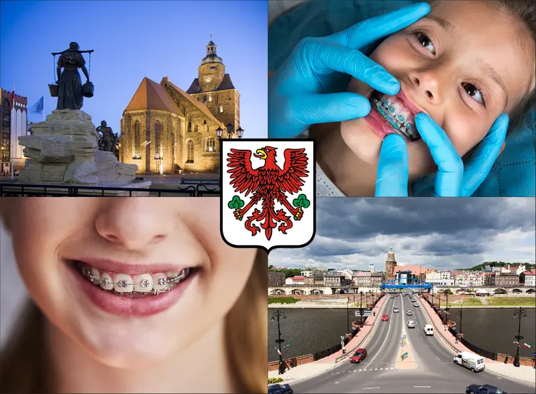 Gorzów Wielkopolski - cennik ortodontów - sprawdź lokalne ceny aparatów na zęby