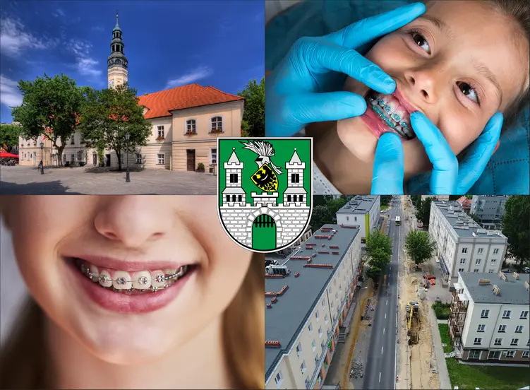 Zielona Góra - cennik ortodontów - sprawdź lokalne ceny aparatów na zęby