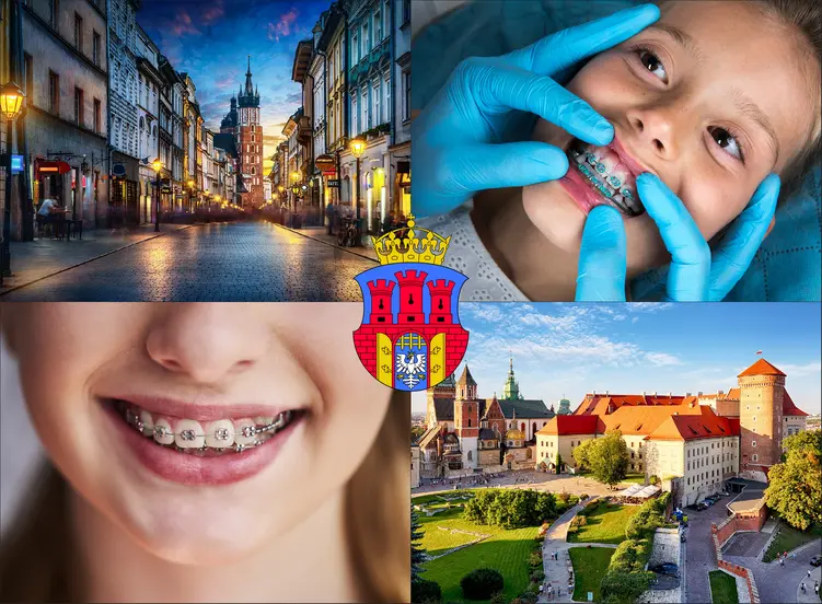Kraków - cennik ortodontów - sprawdź lokalne ceny aparatów na zęby