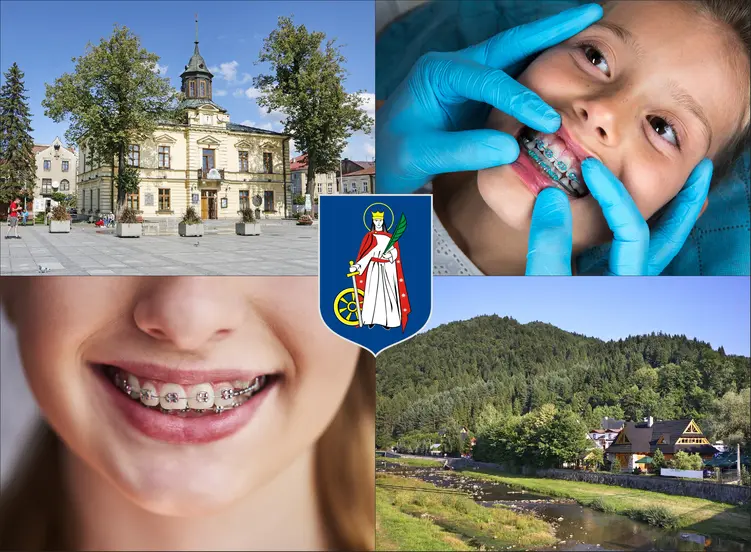 Nowy Targ - cennik ortodontów - sprawdź lokalne ceny aparatów na zęby