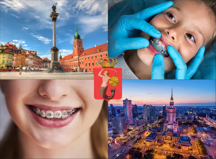 Warszawa - cennik ortodontów - sprawdź lokalne ceny aparatów na zęby