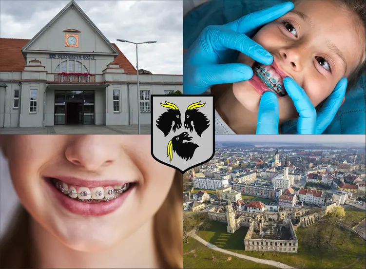 Kędzierzyn-Koźle - cennik ortodontów - sprawdź lokalne ceny aparatów na zęby
