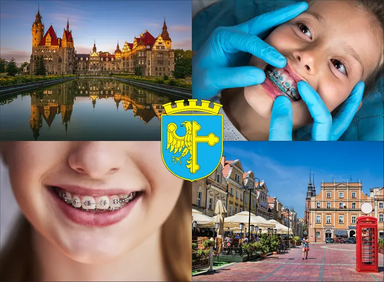 Opole - cennik ortodontów - sprawdź lokalne ceny aparatów na zęby