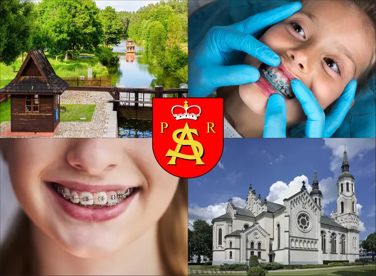 Augustów - cennik ortodontów - sprawdź lokalne ceny aparatów na zęby