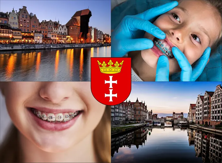 Gdańsk - cennik ortodontów - sprawdź lokalne ceny aparatów na zęby