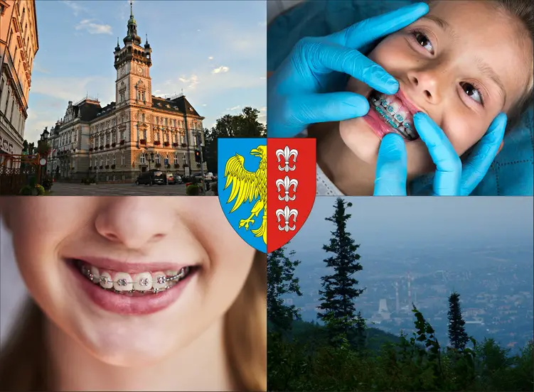 Bielsko-Biała - cennik ortodontów - sprawdź lokalne ceny aparatów na zęby