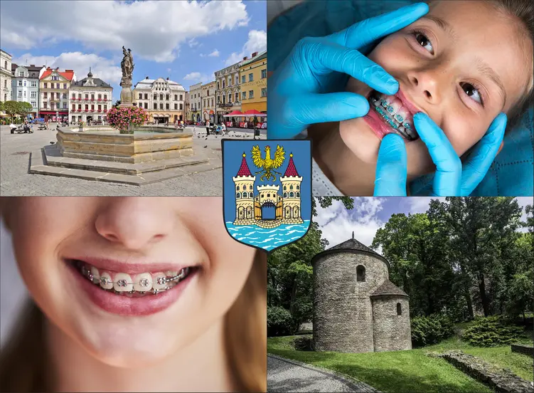 Cieszyn - cennik ortodontów - sprawdź lokalne ceny aparatów na zęby