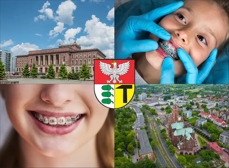 Dąbrowa Górnicza - cennik ortodontów - sprawdź lokalne ceny aparatów na zęby