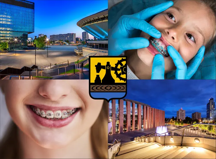 Katowice - cennik ortodontów - sprawdź lokalne ceny aparatów na zęby