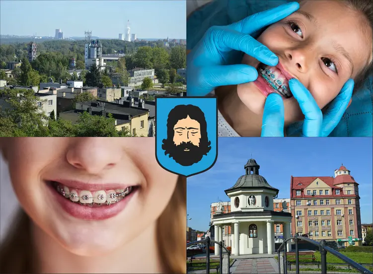 Mysłowice - cennik ortodontów - sprawdź lokalne ceny aparatów na zęby