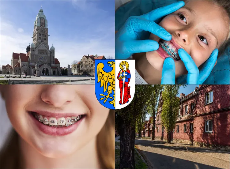 Ruda Śląska - cennik ortodontów - sprawdź lokalne ceny aparatów na zęby