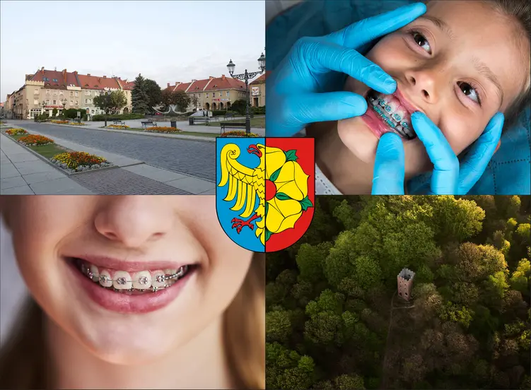 Wodzisław Śląski - cennik ortodontów - sprawdź lokalne ceny aparatów na zęby