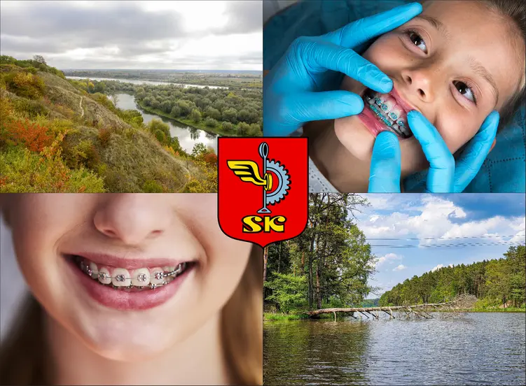Skarżysko-Kamienna - cennik ortodontów - sprawdź lokalne ceny aparatów na zęby