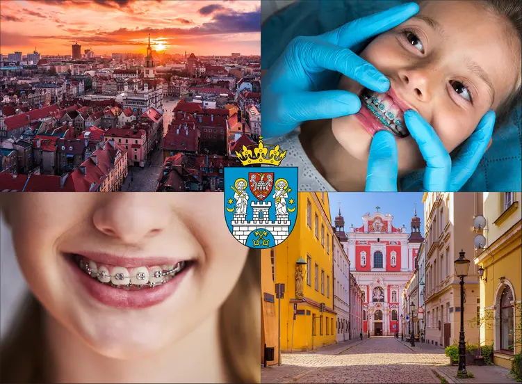 Poznań - cennik ortodontów - sprawdź lokalne ceny aparatów na zęby