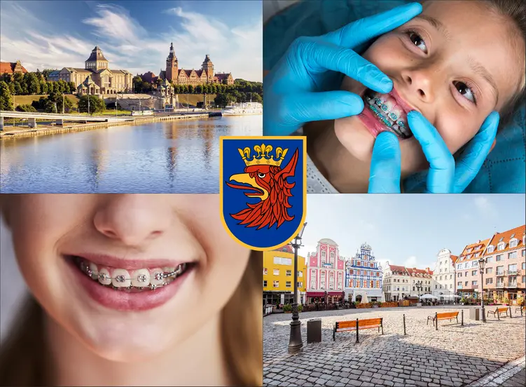 Szczecin - cennik ortodontów - sprawdź lokalne ceny aparatów na zęby