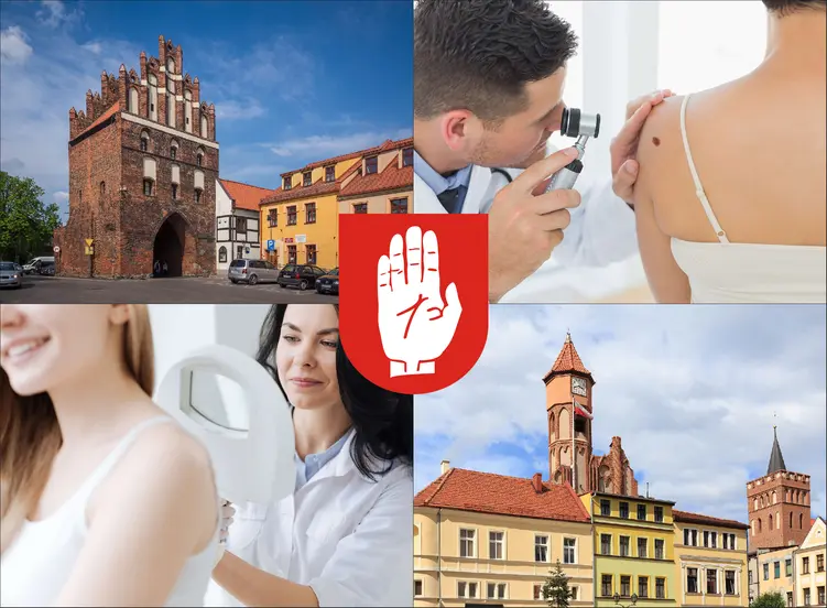 Brodnica - cennik dermatologów - zobacz lokalne ceny prywatnych wizyt