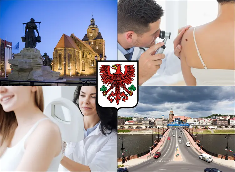 Gorzów Wielkopolski - cennik dermatologów prywatnie