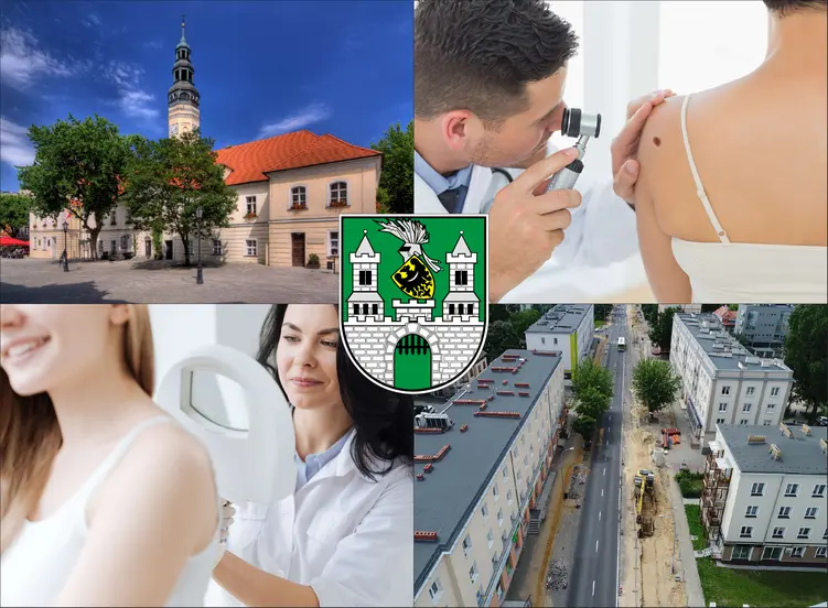 Zielona Góra - cennik dermatologów - zobacz lokalne ceny prywatnych wizyt