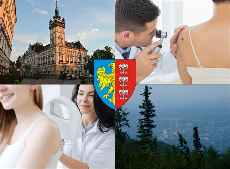 Bielsko-Biała - cennik dermatologów - zobacz lokalne ceny prywatnych wizyt