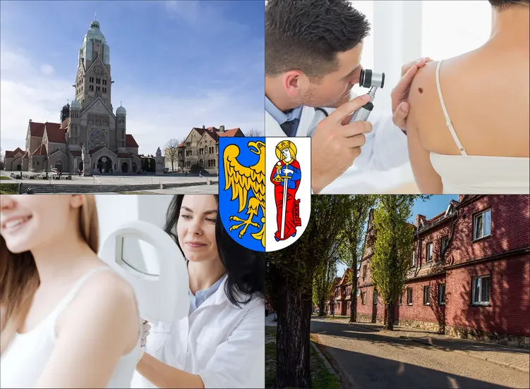 Ruda Śląska - cennik dermatologów prywatnie