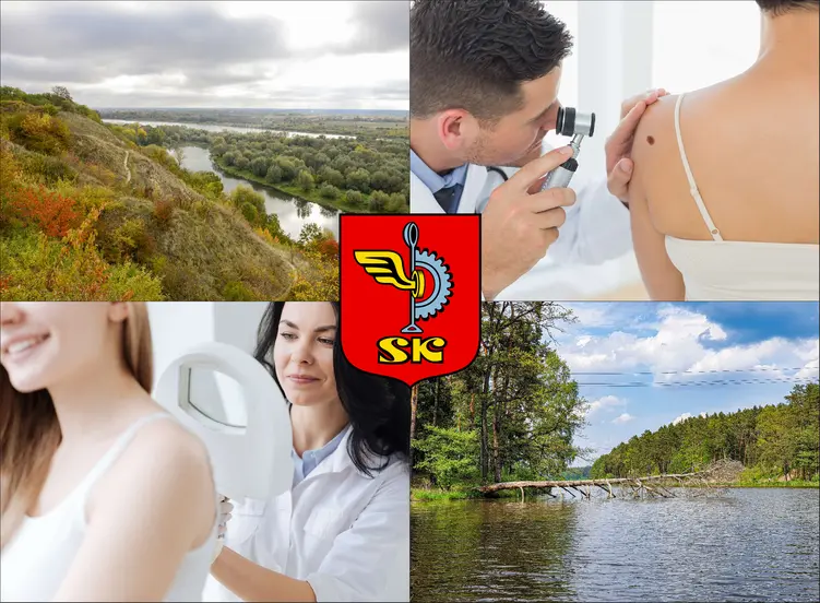 Skarżysko-Kamienna - cennik dermatologów - zobacz lokalne ceny prywatnych wizyt
