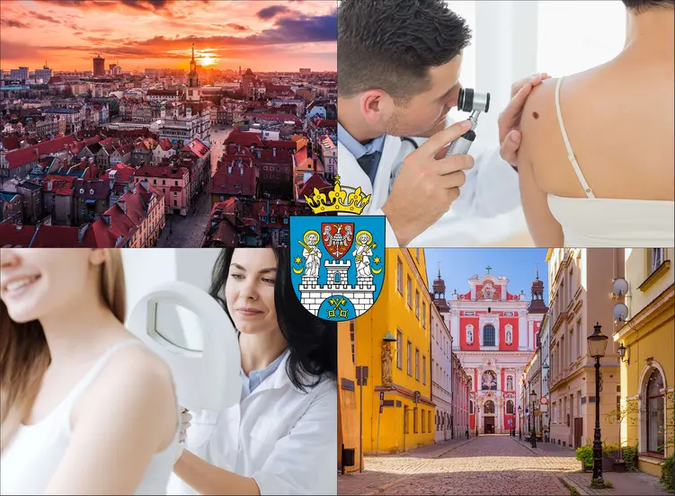 Poznań - cennik dermatologów - zobacz lokalne ceny prywatnych wizyt