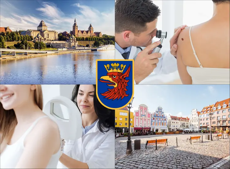 Szczecin - cennik dermatologów prywatnie