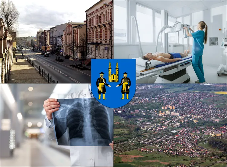 Piekary Śląskie - cennik rtg - sprawdź lokalne ceny badań rentgenowskich
