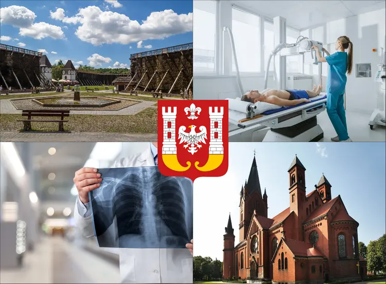 Inowrocław - cennik rtg - sprawdź lokalne ceny badań rentgenowskich