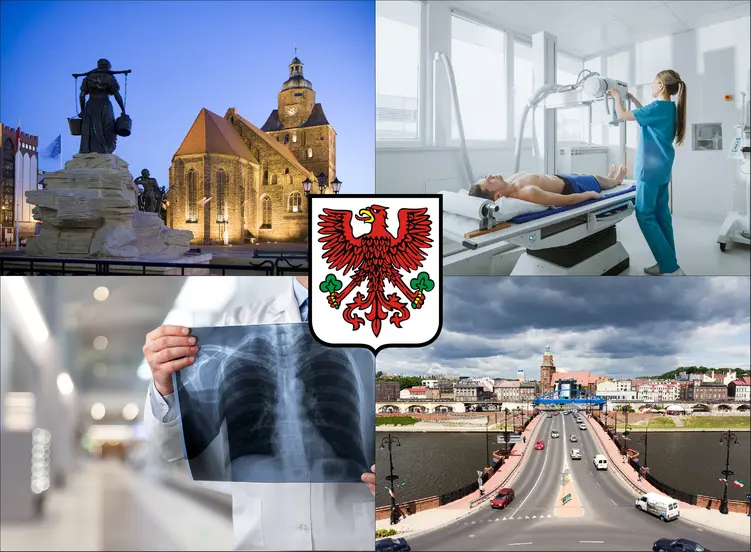 Gorzów Wielkopolski - cennik rtg - sprawdź lokalne ceny badań rentgenowskich
