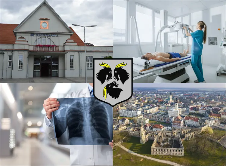 Kędzierzyn-Koźle - cennik rtg - sprawdź lokalne ceny badań rentgenowskich