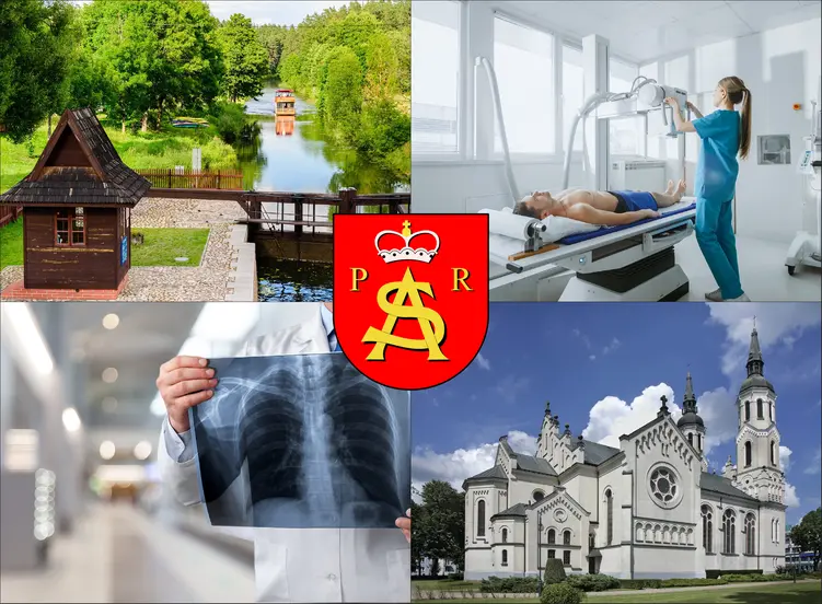 Augustów - cennik rtg - sprawdź lokalne ceny badań rentgenowskich