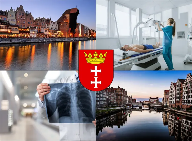 Gdańsk - cennik rtg - sprawdź lokalne ceny badań rentgenowskich