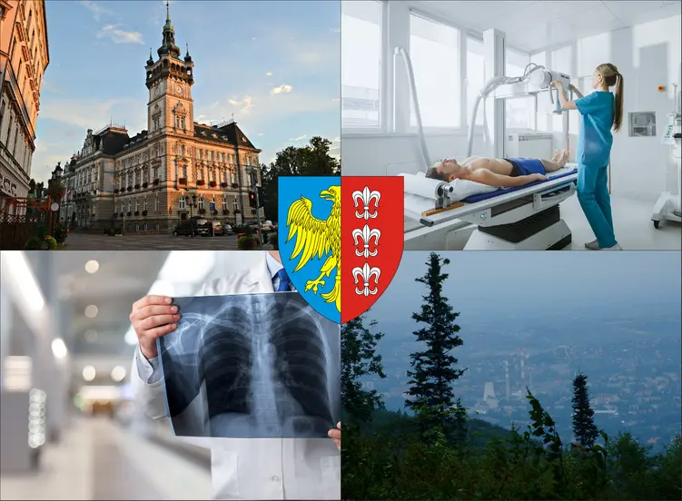 Bielsko-Biała - cennik rtg - sprawdź lokalne ceny badań rentgenowskich