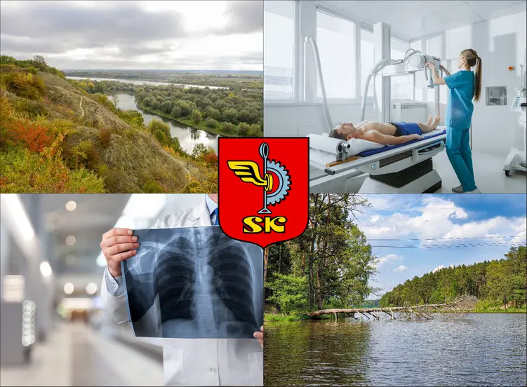 Skarżysko-Kamienna - cennik rtg - sprawdź lokalne ceny badań rentgenowskich