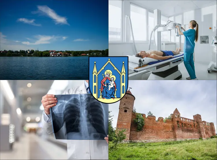 Iława - cennik rtg - sprawdź lokalne ceny badań rentgenowskich