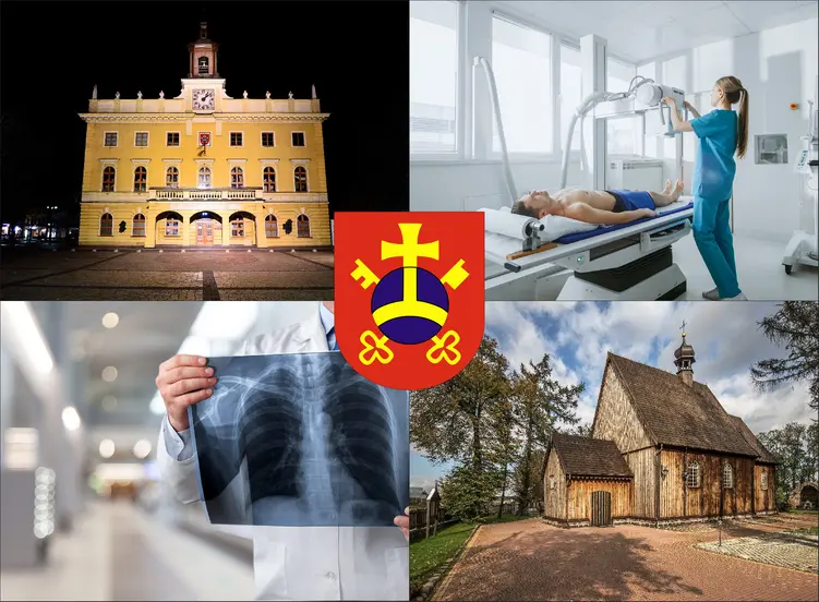 Ostrów Wielkopolski - cennik rtg - sprawdź lokalne ceny badań rentgenowskich