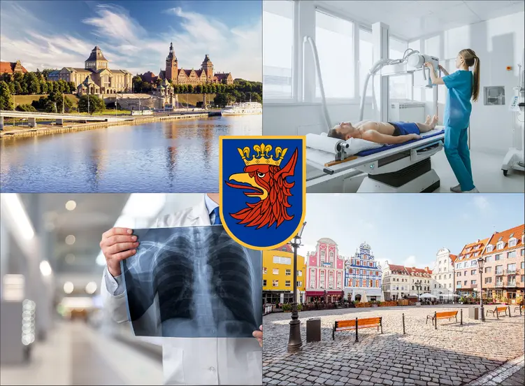 Szczecin - cennik rtg - sprawdź lokalne ceny badań rentgenowskich