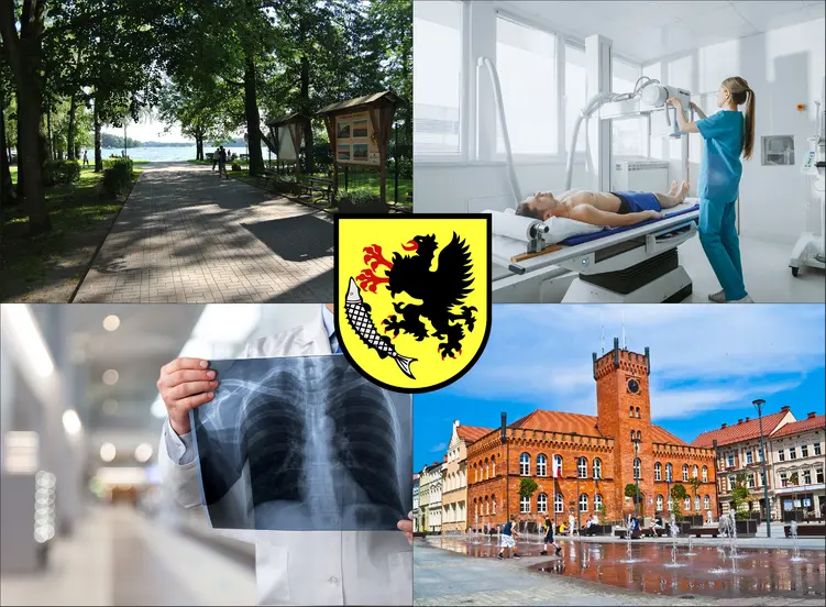 Szczecinek - cennik rtg - sprawdź lokalne ceny badań rentgenowskich