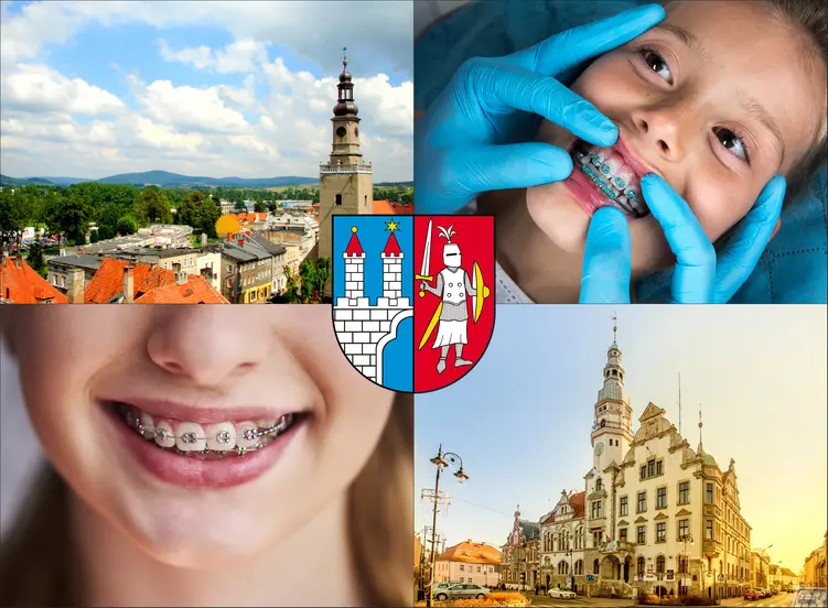 Kamienna Góra - cennik ortodontów - sprawdź lokalne ceny aparatów na zęby