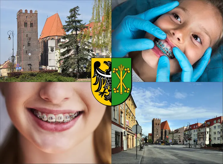 Środa Śląska - cennik ortodontów - sprawdź lokalne ceny aparatów na zęby