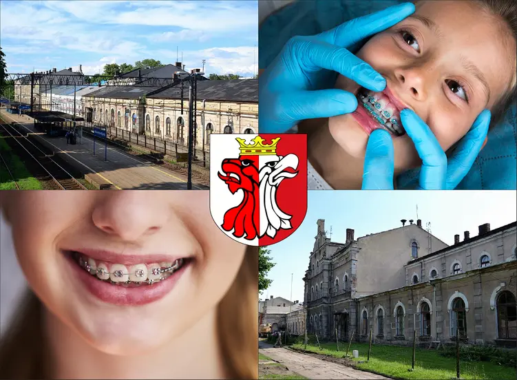 Aleksandrów Kujawski - cennik ortodontów - sprawdź lokalne ceny aparatów na zęby