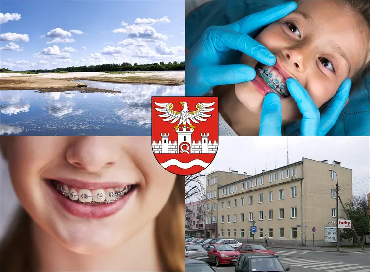 Nowy Dwór Mazowiecki - cennik ortodontów - sprawdź lokalne ceny aparatów na zęby