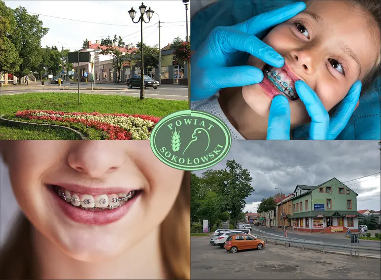 Sokołów Podlaski - cennik ortodontów - sprawdź lokalne ceny aparatów na zęby